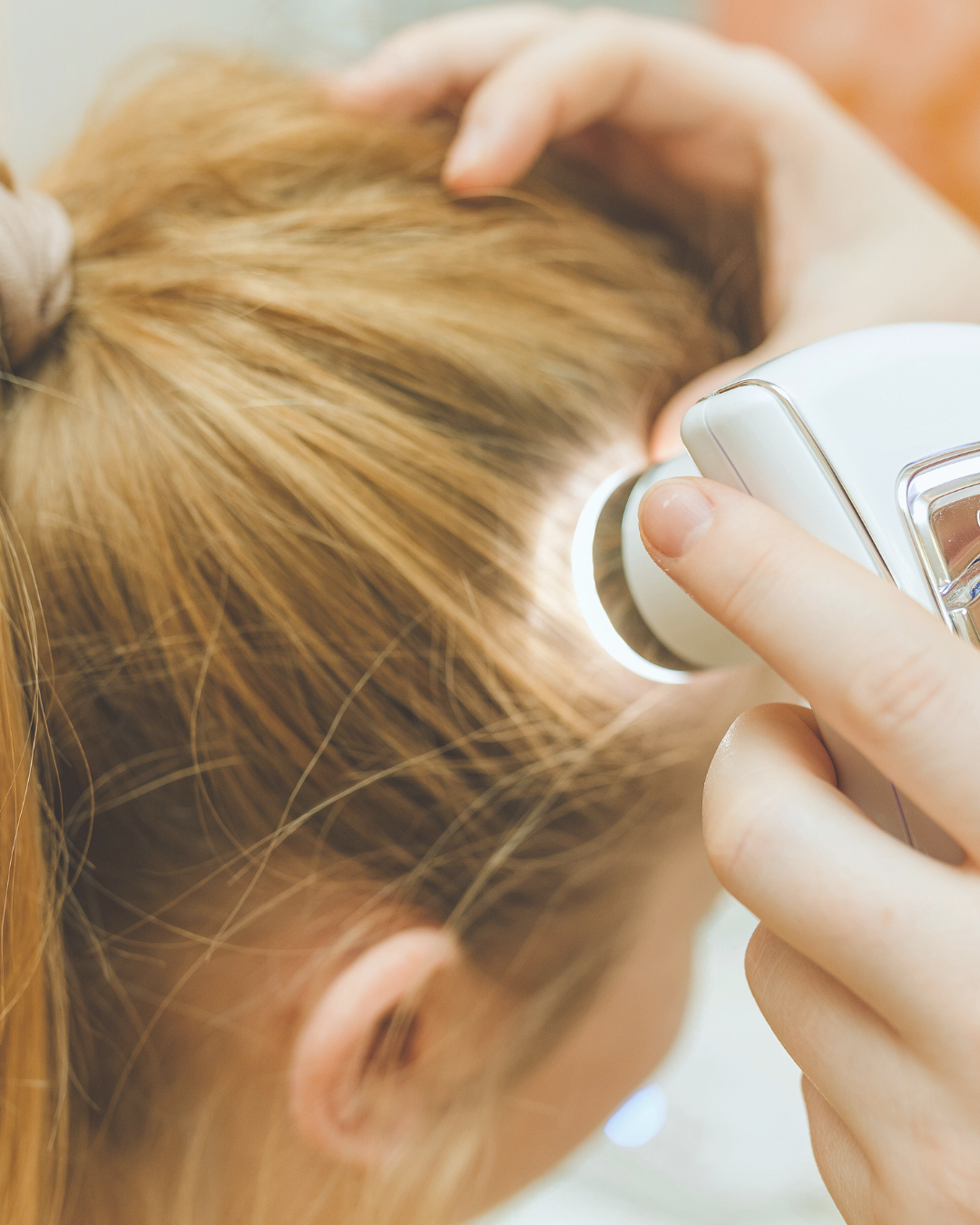 Protocolo tricológico, cuidados capilares personalizados, cuidados com o cabelo, cuidados com couro cabeludo, couro cabeludo, fios, Cronograma capilar, Saúde do cabelo, Acompanhamento capilar