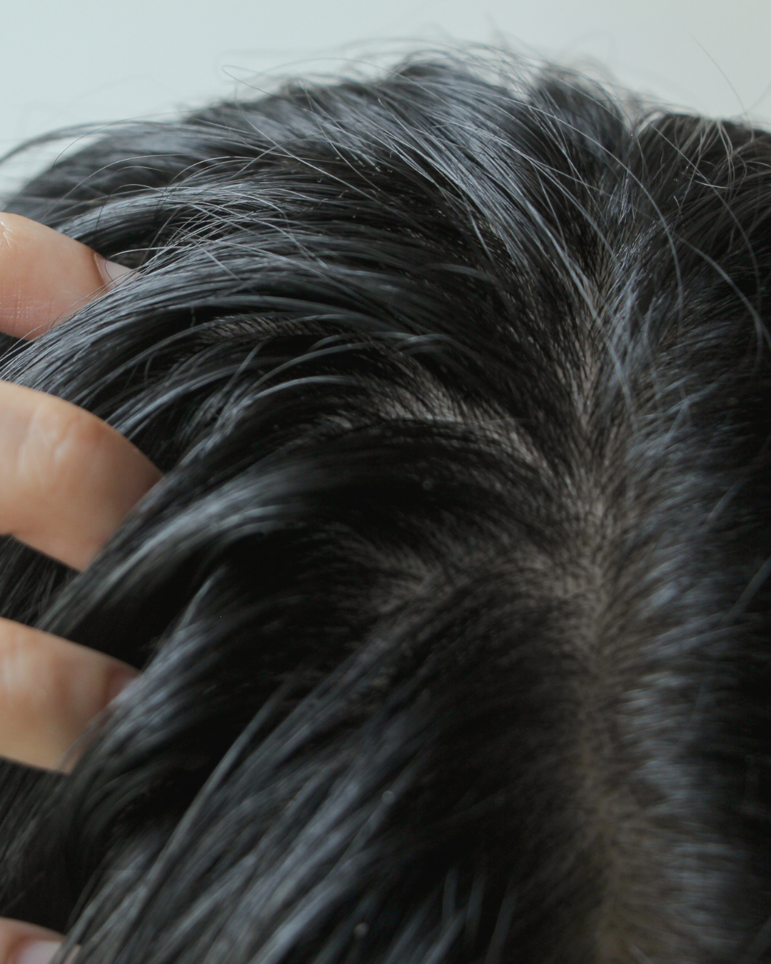 Couro Cabeludo e a sua importância para a saúde capilar